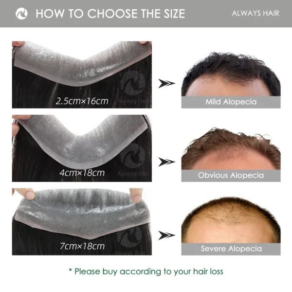 Dyeable Men Hairline Toupee Real Human Hair Forehead Hair Replacement